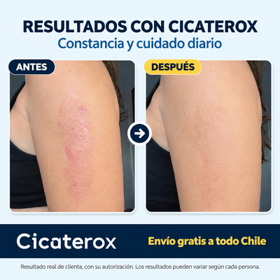 Cicaterox – Spray para Eliminar Cicatrices