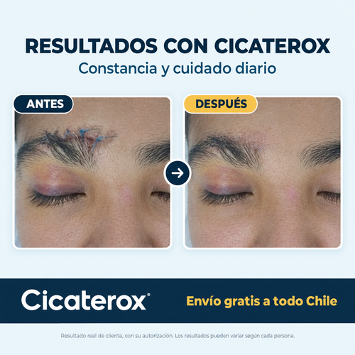 Cicaterox – Spray para Eliminar Cicatrices